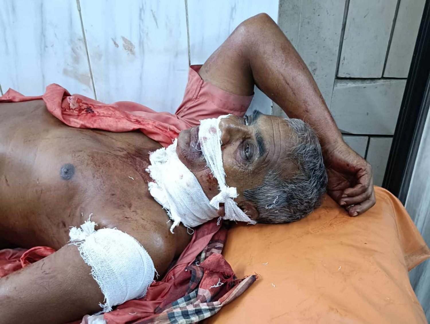 Attempt to kill old fisherman by stabbing throat in Chatmohar