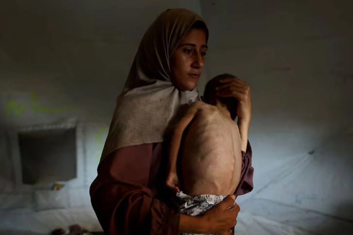 গাজায় অনাহার-অপুষ্টিতে আরও ১১ জনের মৃত্যু, শিশু নিহত ৯৮