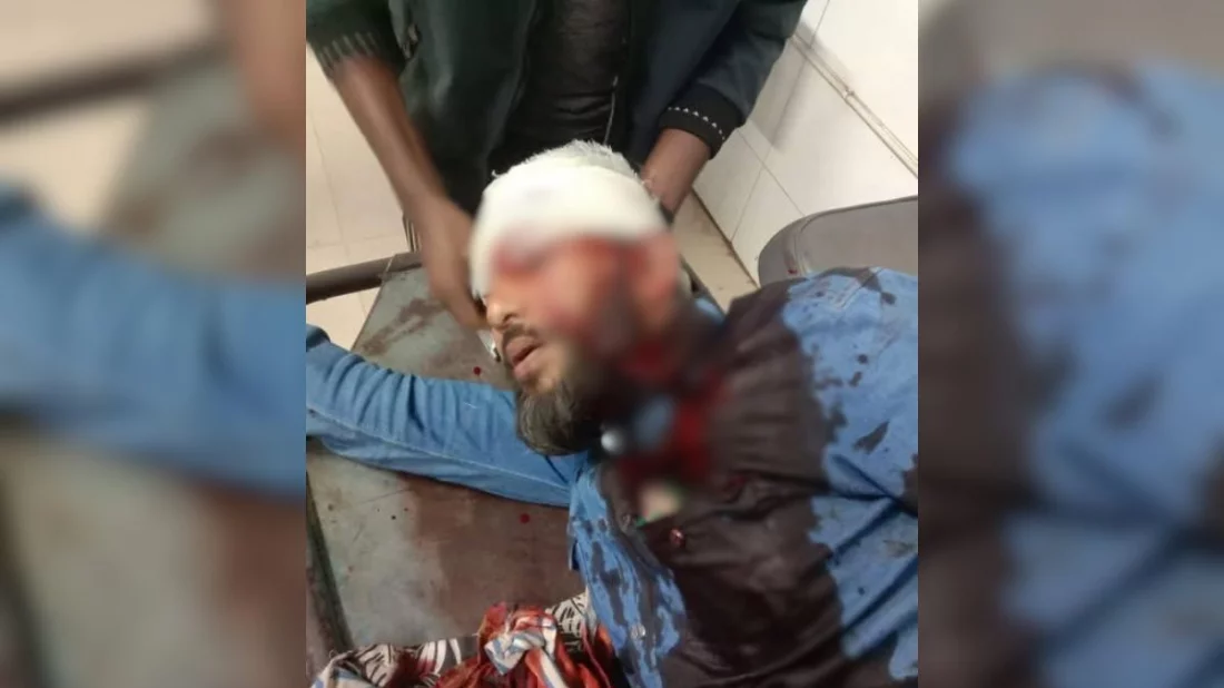 খুলনায় এনসিপি নেতার উপর প্রকাশ্যে গুলি, সংকটাপন্ন অবস্থায় হাসপাতালে